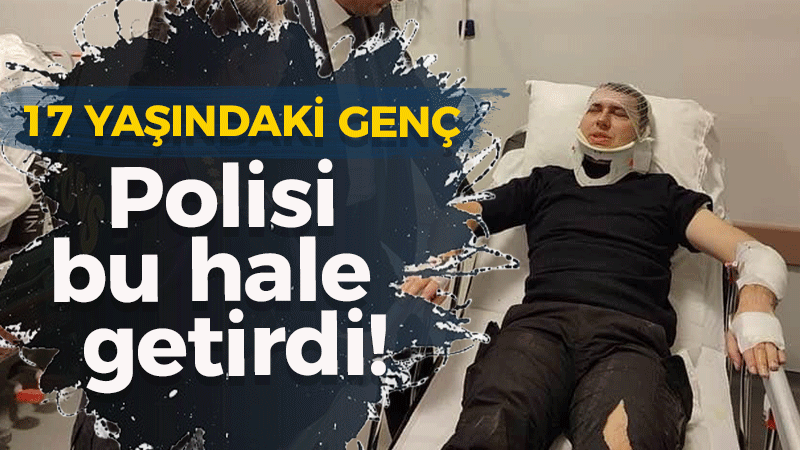 17 YAŞINDAKİ GENÇ Polisi bu hale  getirdi!