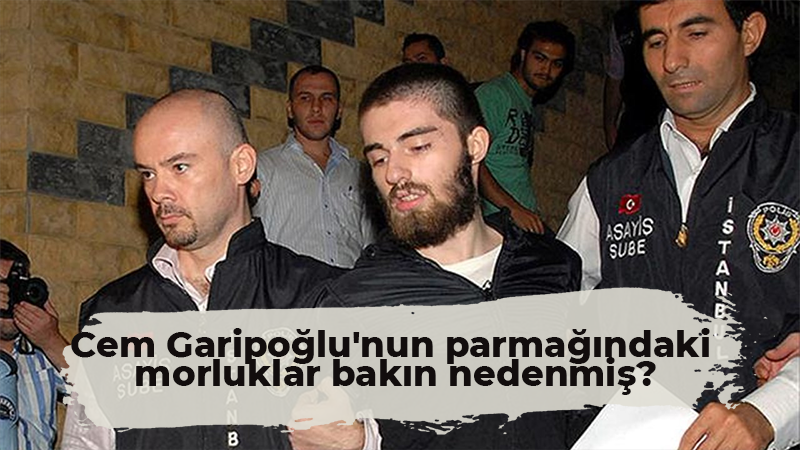 Cem Garipoğlu’nun parmağındaki morluklar bakın nedenmiş?