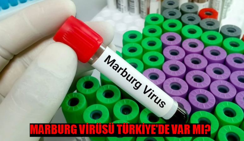 Ölümcül Marburg virüsü dünyayı